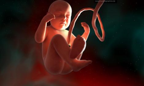 Image description: Foetus with umblical cord