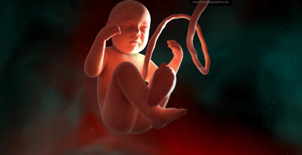 Image description: Foetus with umblical cord